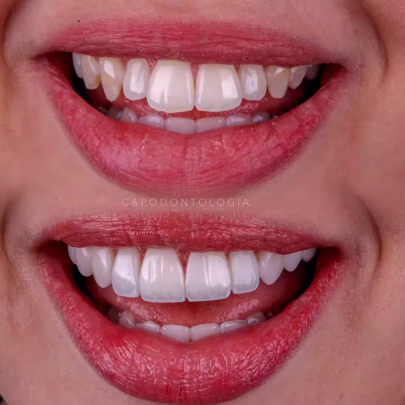 Sorriso Radiante