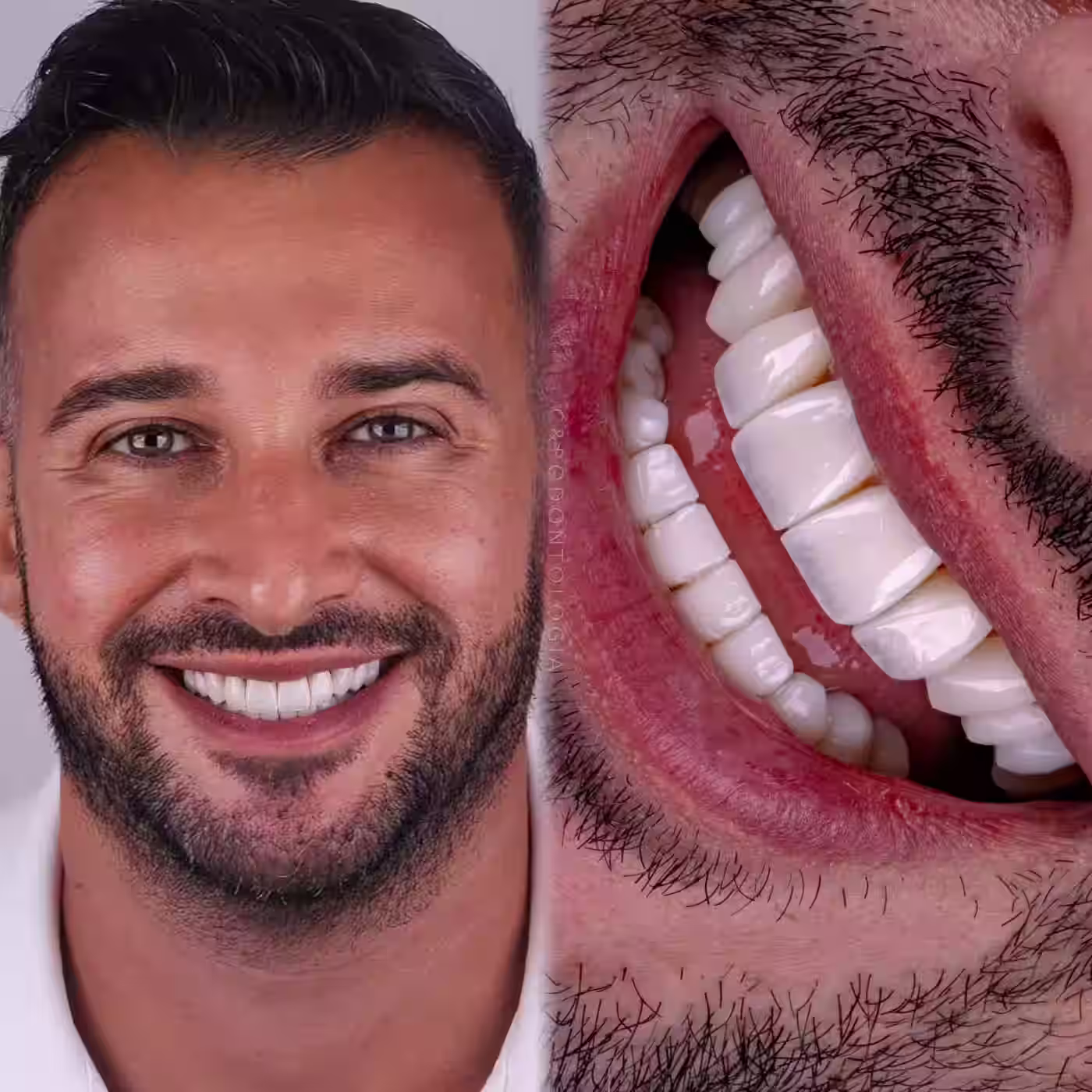 Sorriso com Confiança