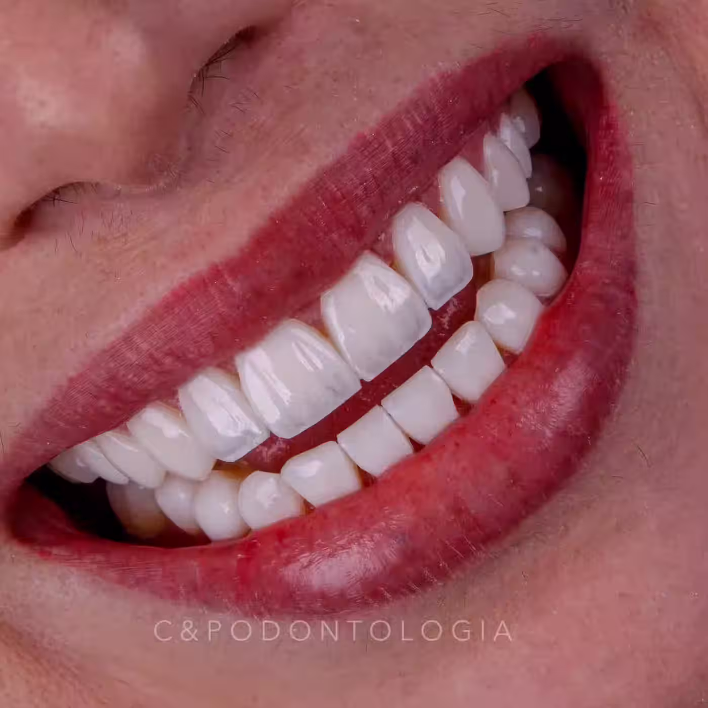 Sorriso Leve
